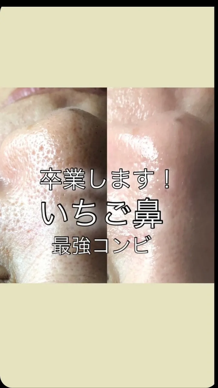 ＼脱！いちご鼻／