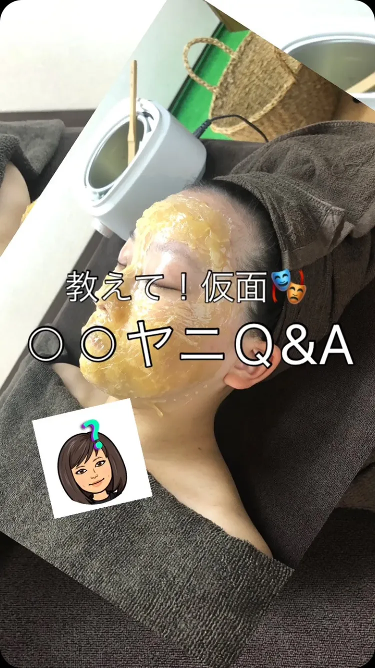 ＼マツヤニQ&A／