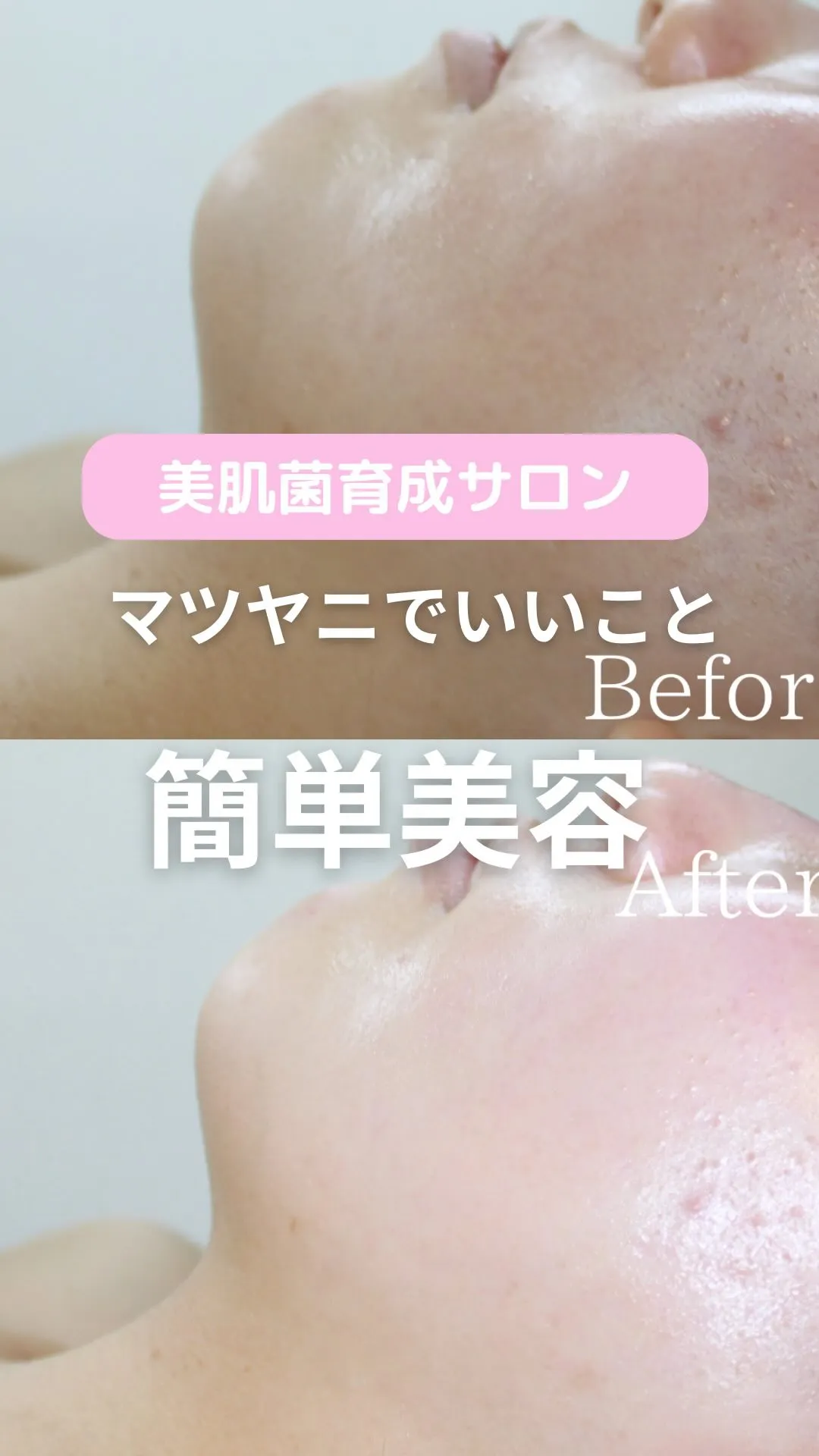 ＼マツヤニでいいこと／