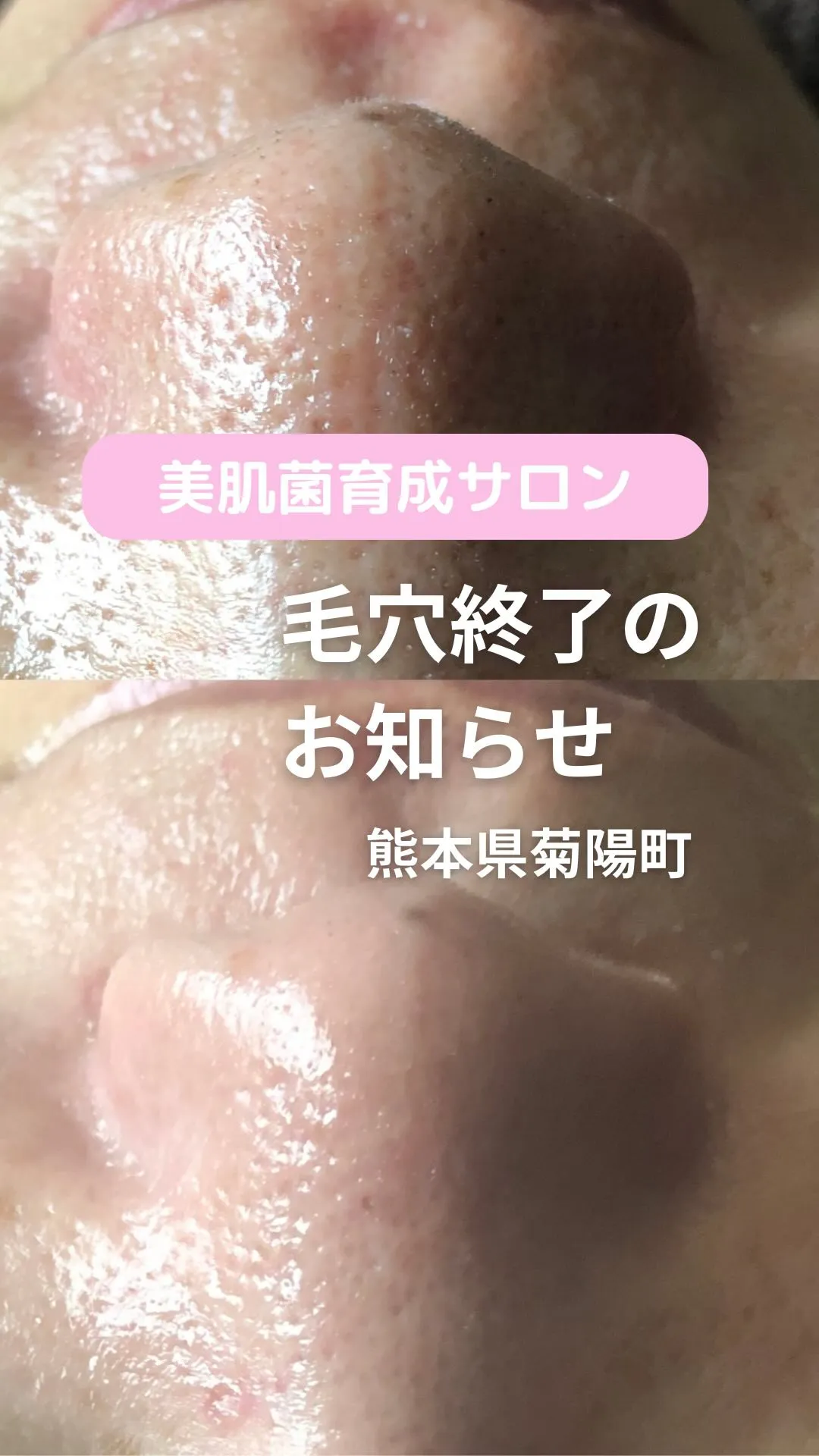 ＼これやると毛穴終了します／