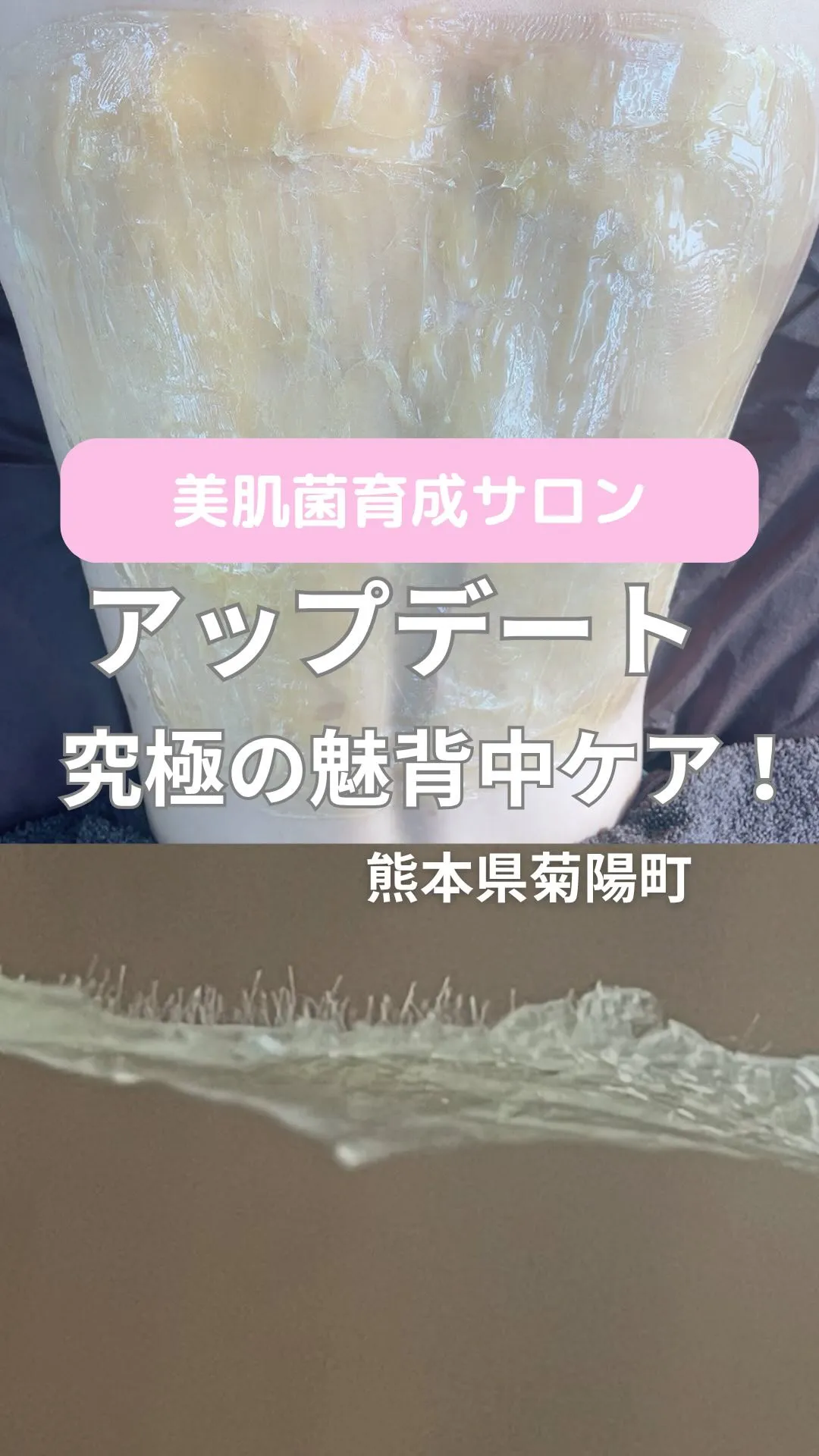 ＼究極の魅背中ケア／
