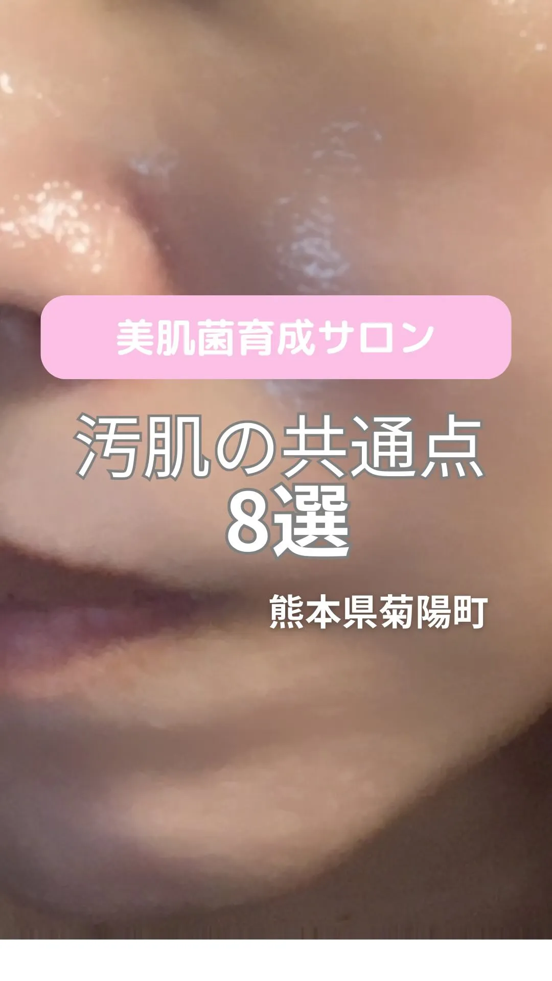 ＼汚肌の共通点／