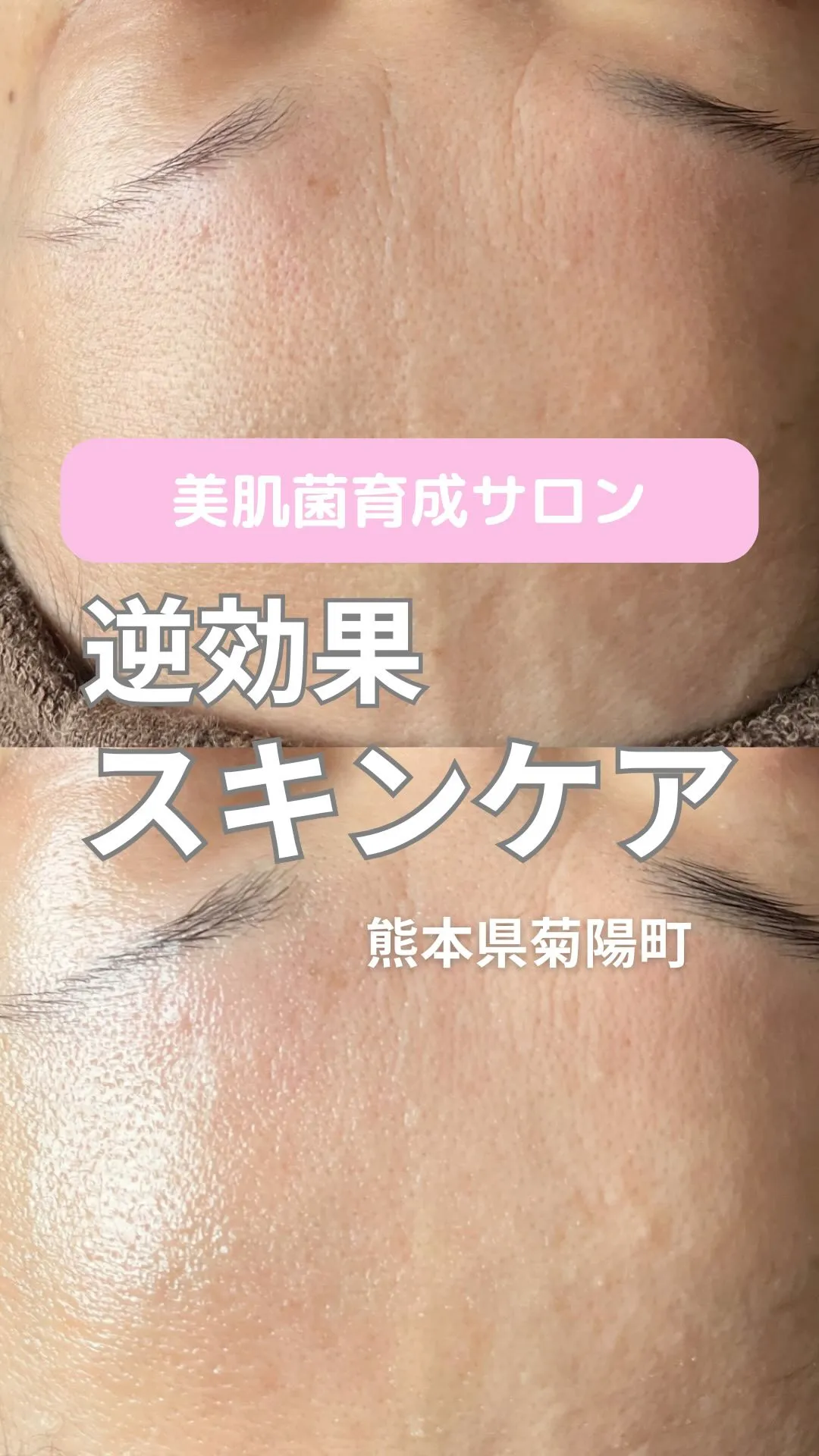 ＼逆効果スキンケア／