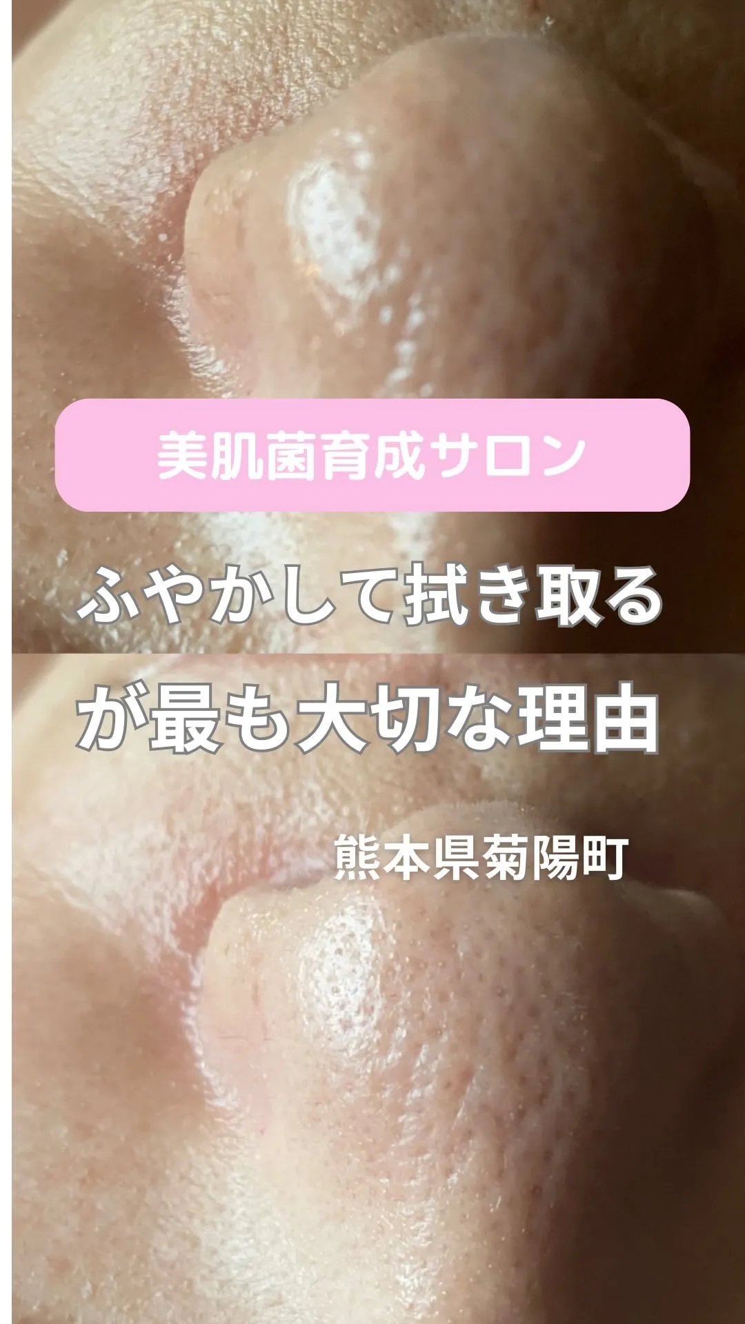 ＼角質をふやかして拭き取るケアが必要な理由／