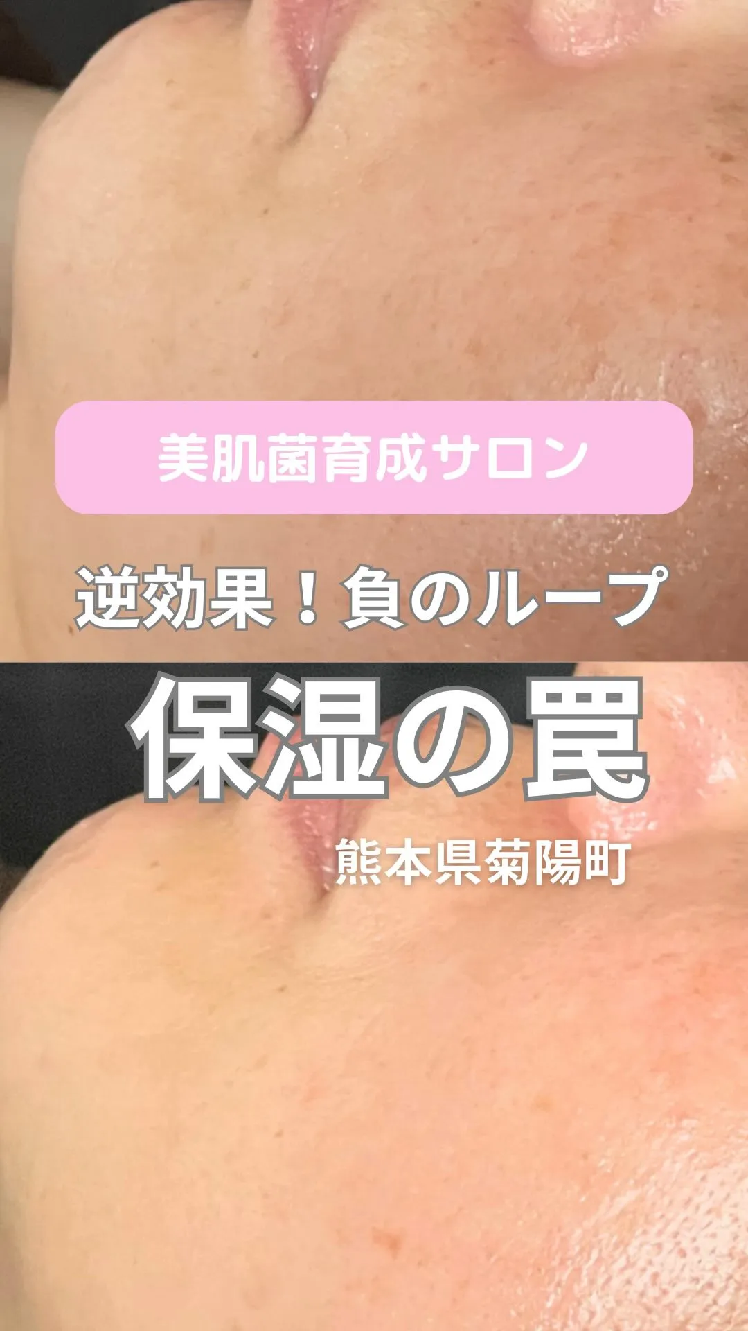 ＼逆効果！？保湿の罠／