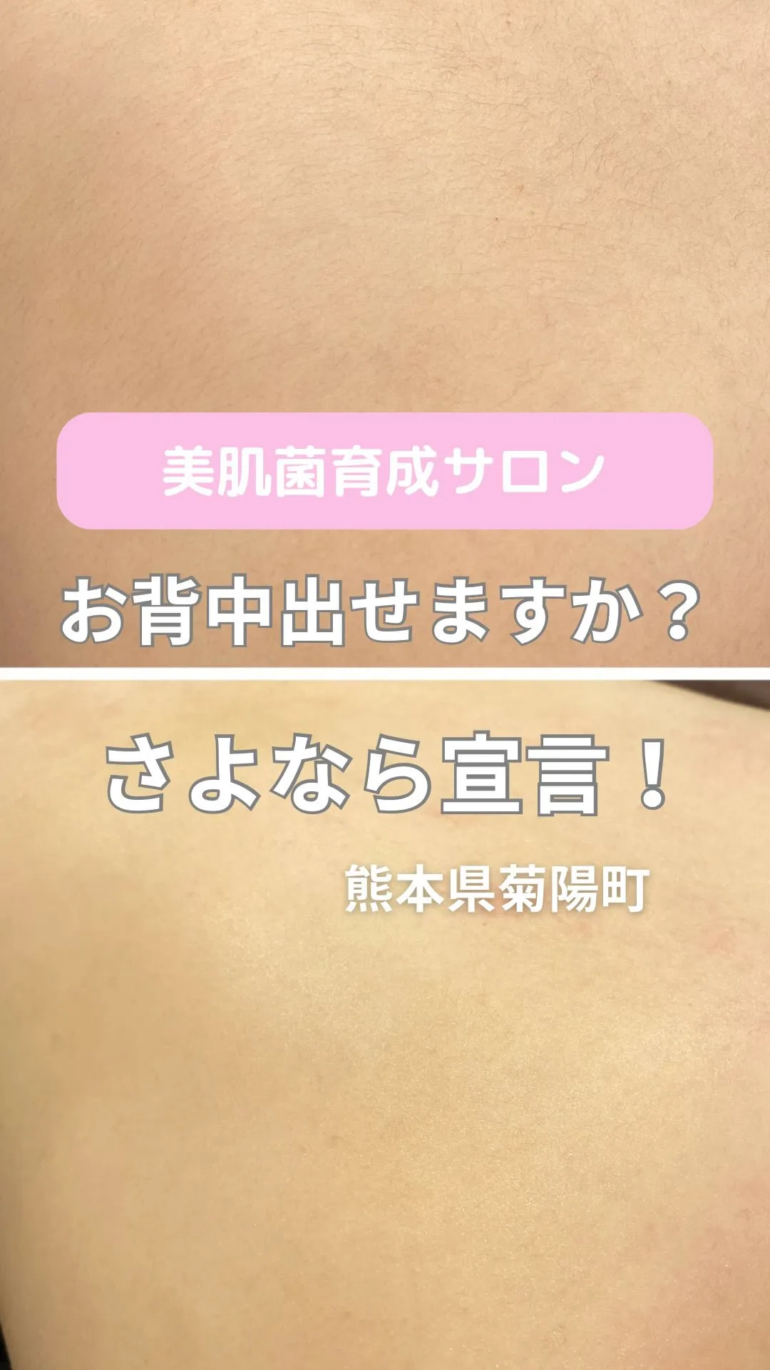 ＼さよなら宣言、汚背中／