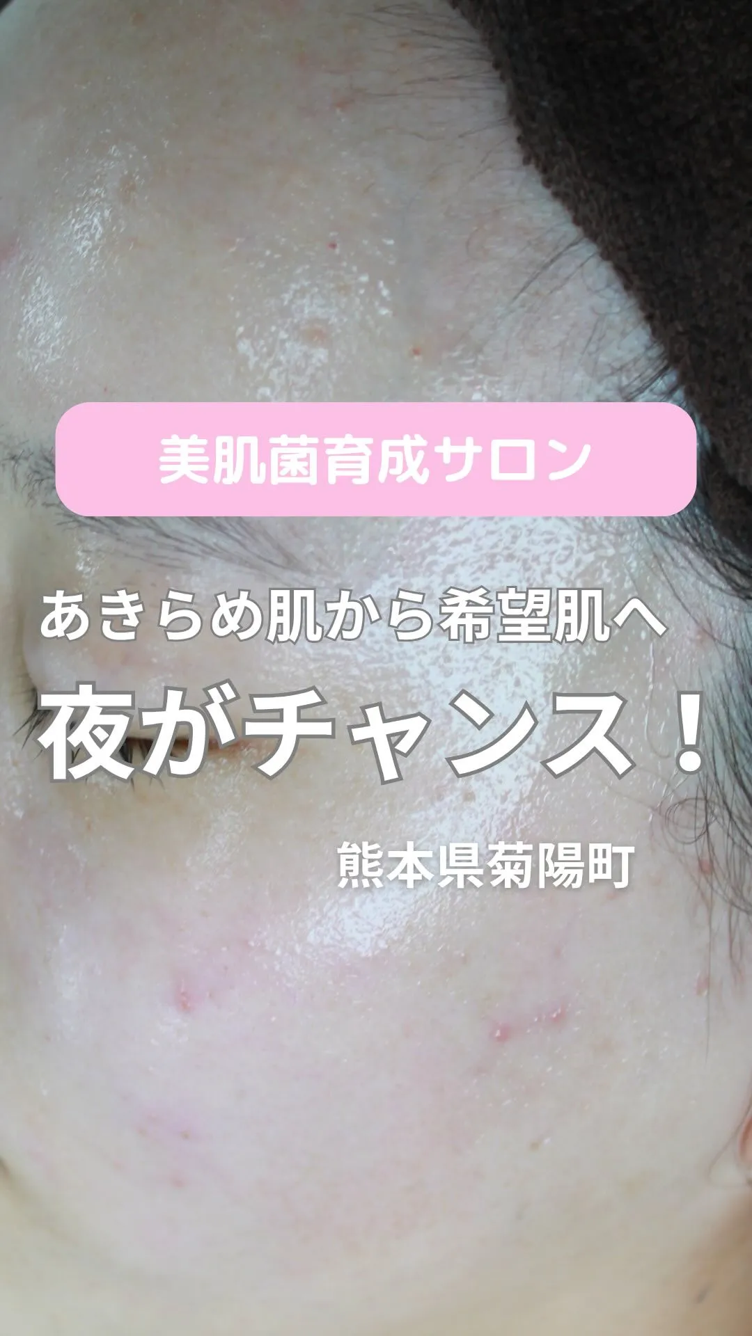 ＼夜がチャンス！諦め肌から希望肌へ／