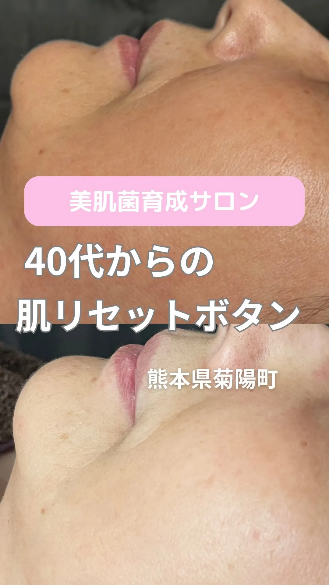 ＼40代からの肌リセットボタン／