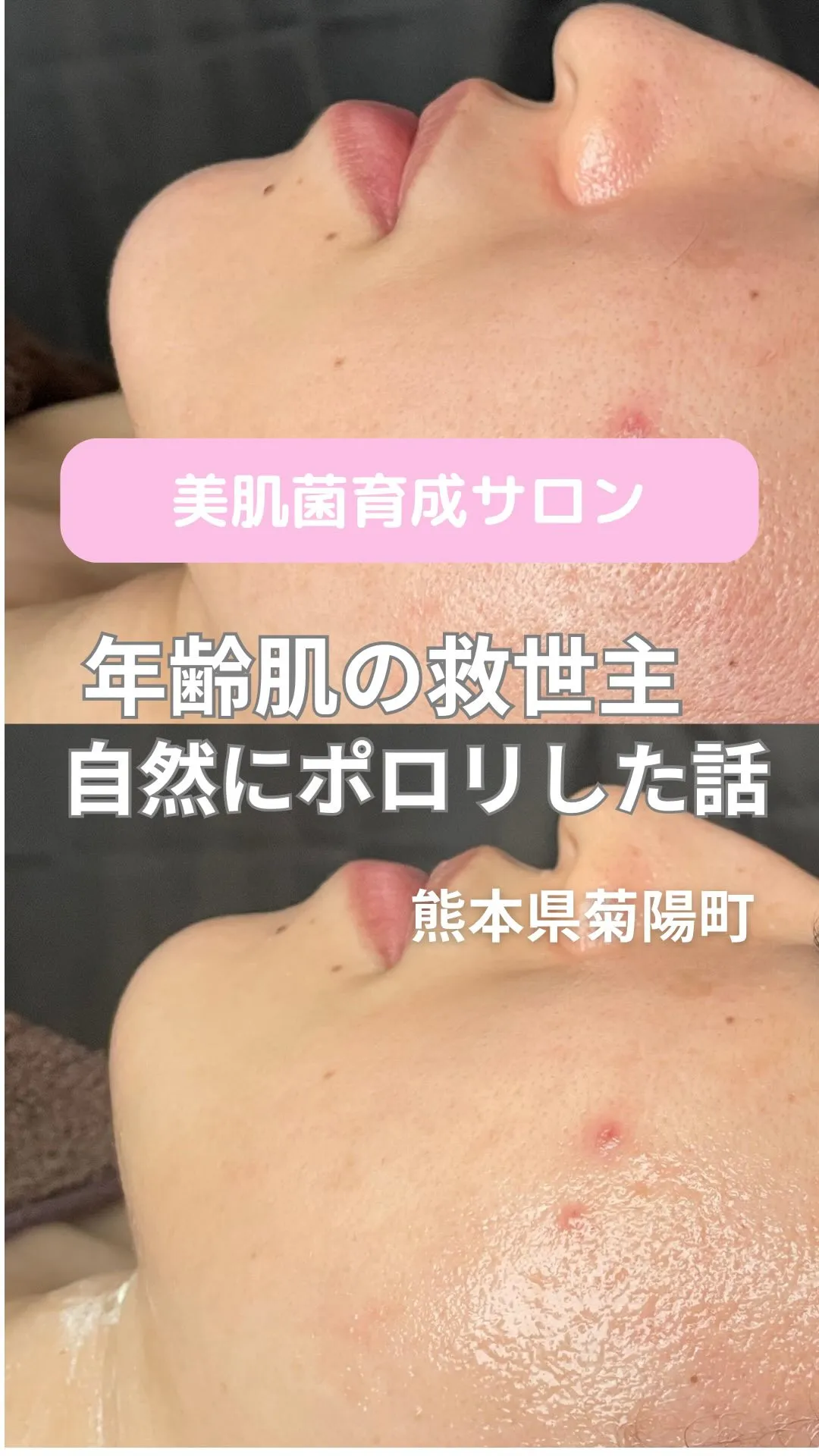 ＼年齢肌の救世主！自然にポロリした話／