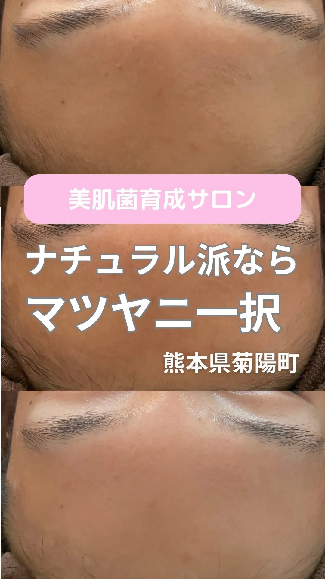 ＼ナチュラル派ならマツヤニ一択／