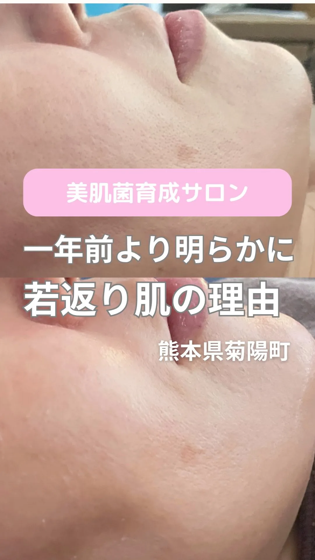 ＼一年前より若返り肌の理由／