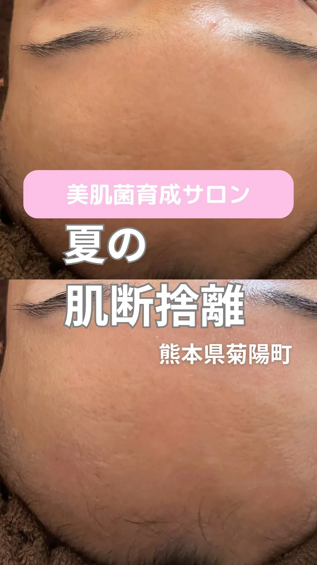 ＼夏こそ“肌断捨離”／