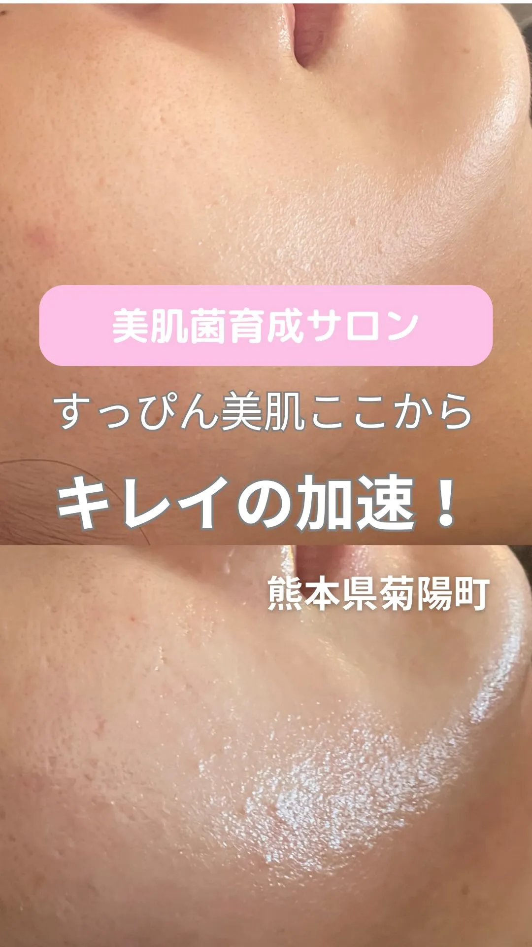 ＼キレイの加速はここから／