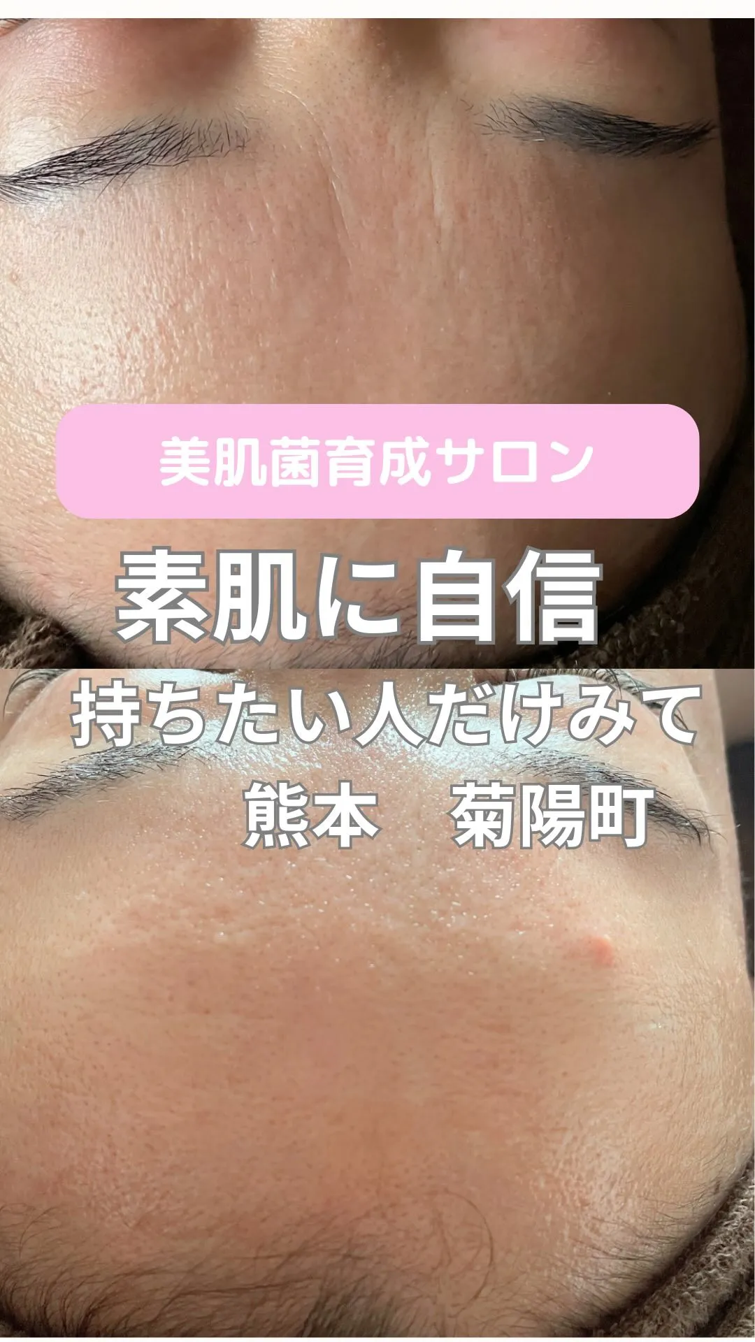 ＼📌素肌に自信を持ちたい方だけみて／