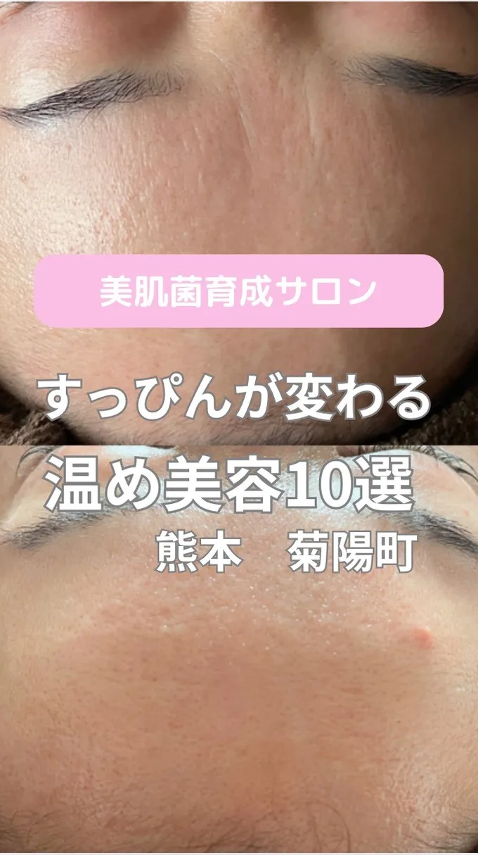 ＼すっぴんが変わる温め美容10選／