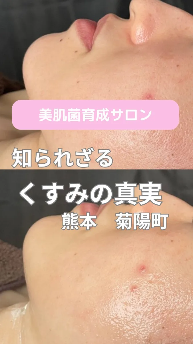 ＼知られざるくすみの真実／