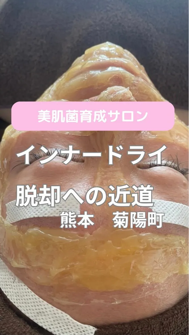 ＼その保湿が間違ってるサイン／