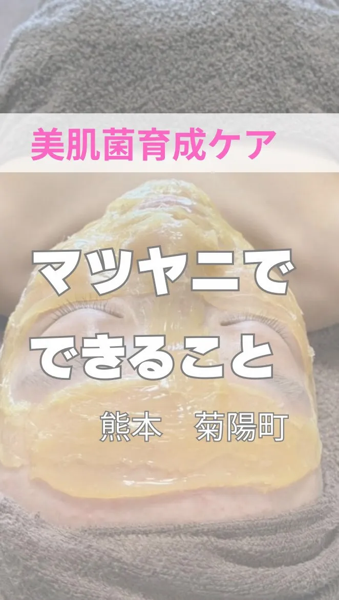 マツヤニでできること。