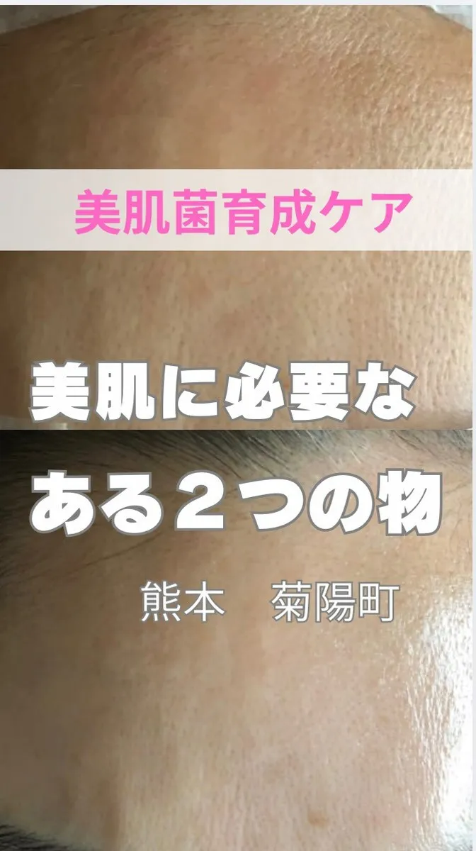 ＼美肌に必要なある二つのもの／