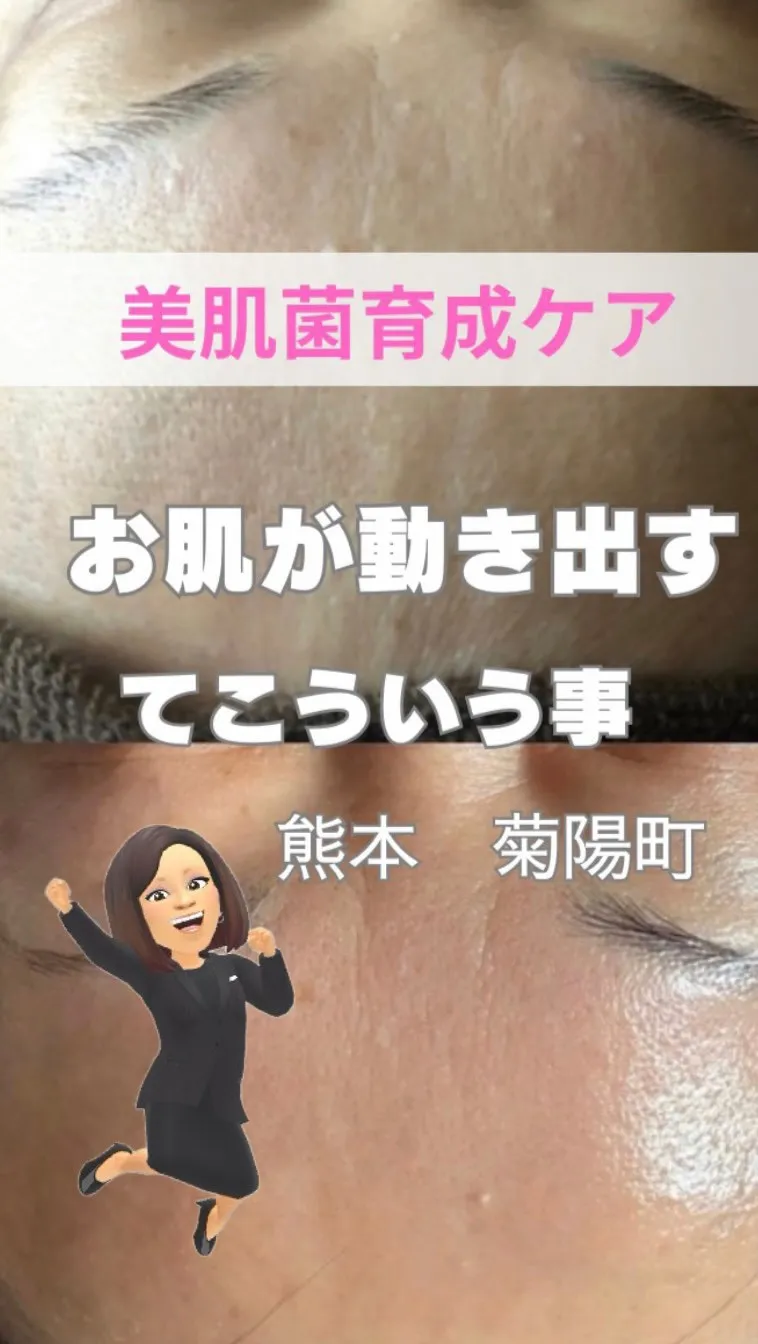 ＼お肌が動き出すってこゆこと／