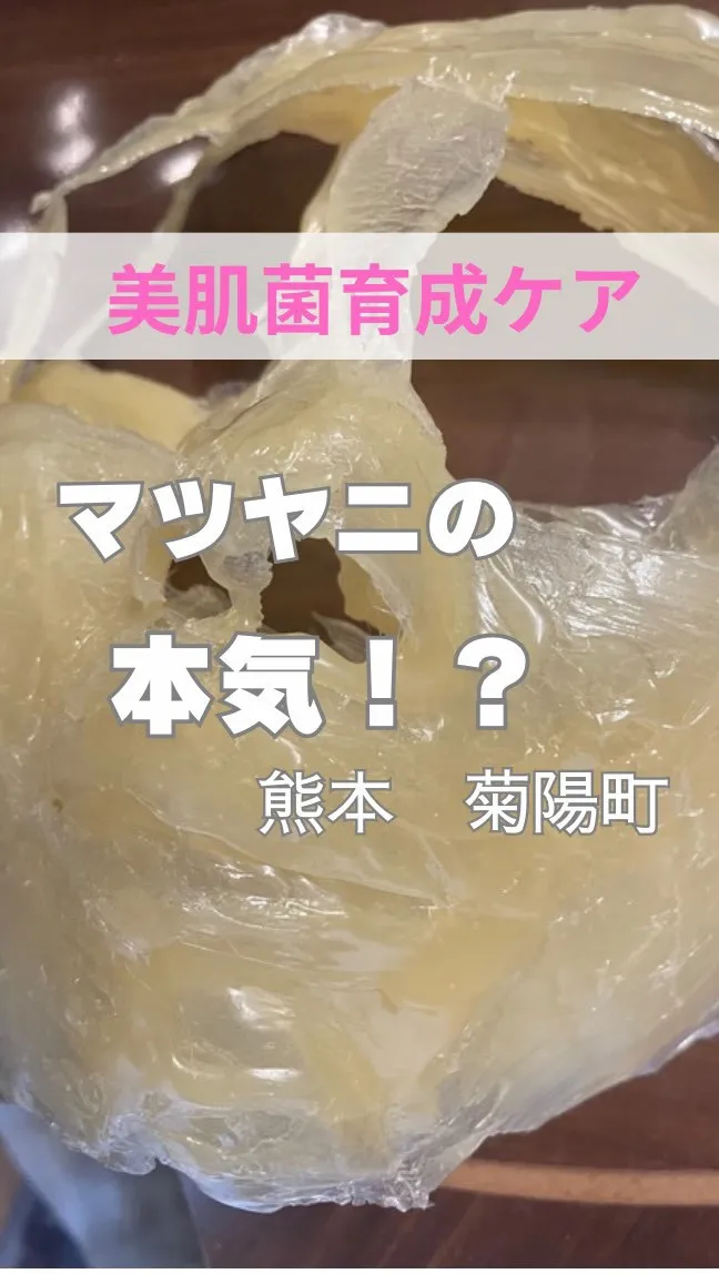 ＼マツヤニホットセラピーの本気？！／