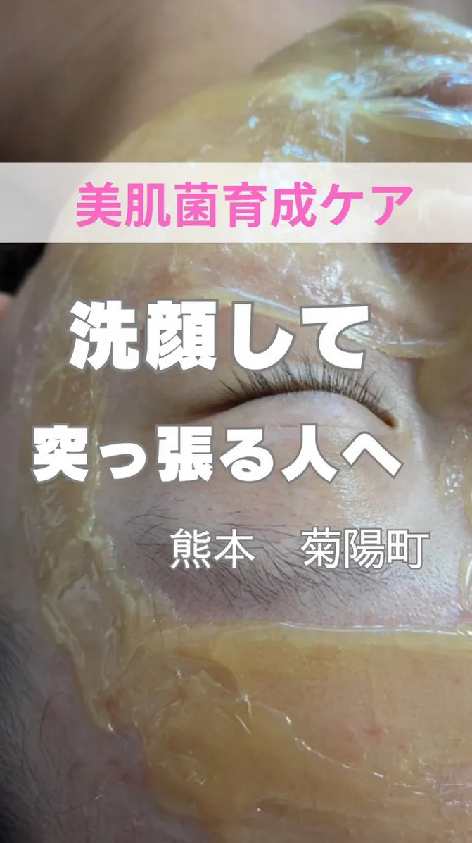 ＼洗顔後つっぱる人／