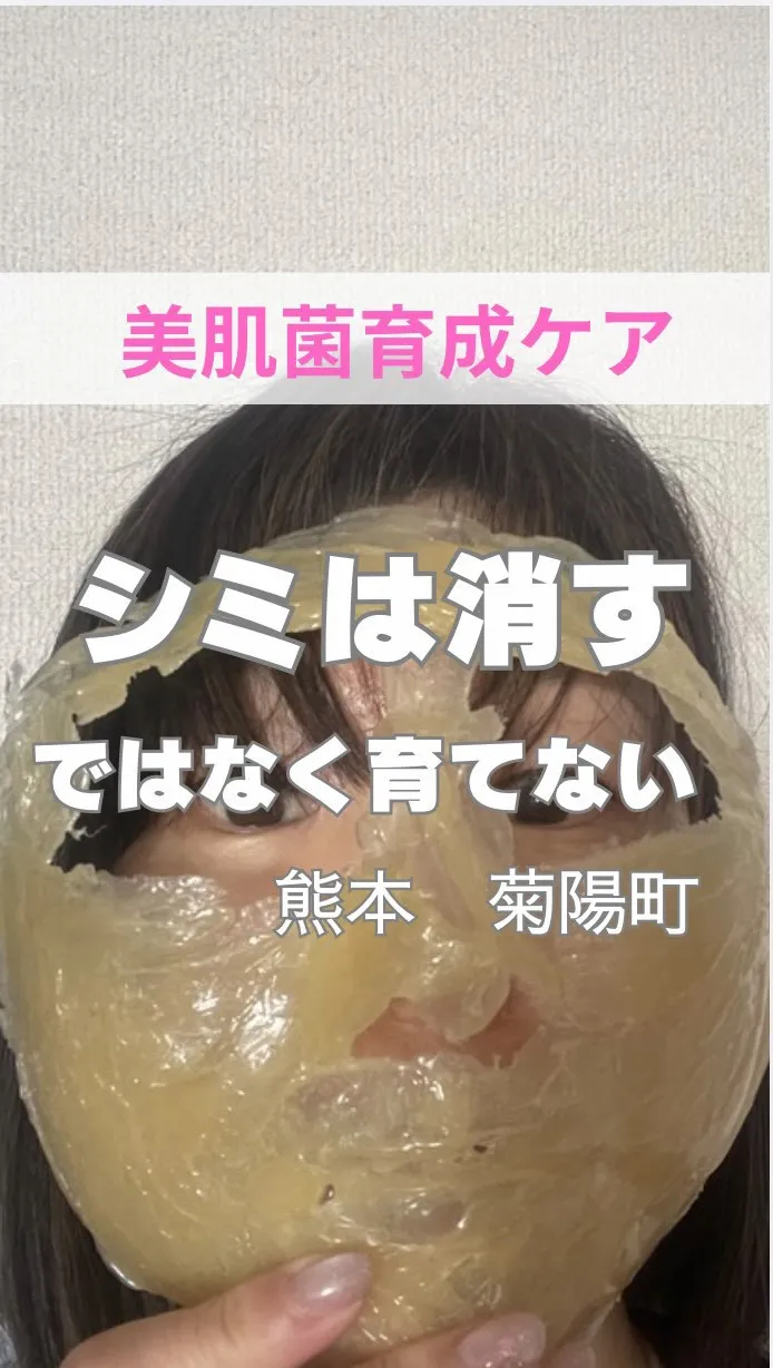 ＼シミは消すではなく育てない／