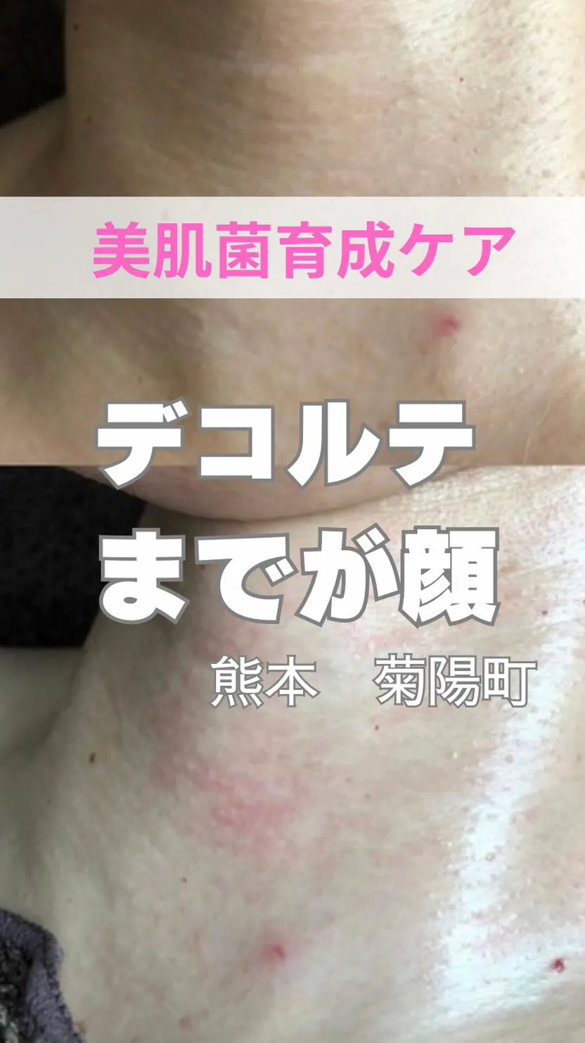 ＼デコルテまでが顔／