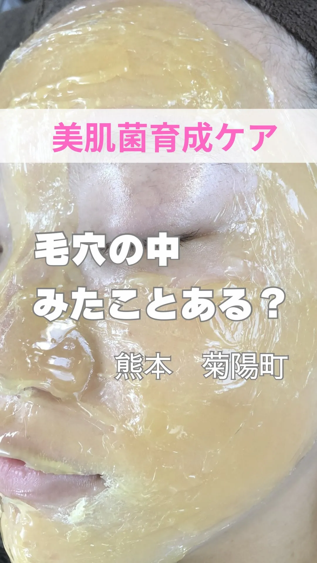 ＼毛穴の中みたことある？／