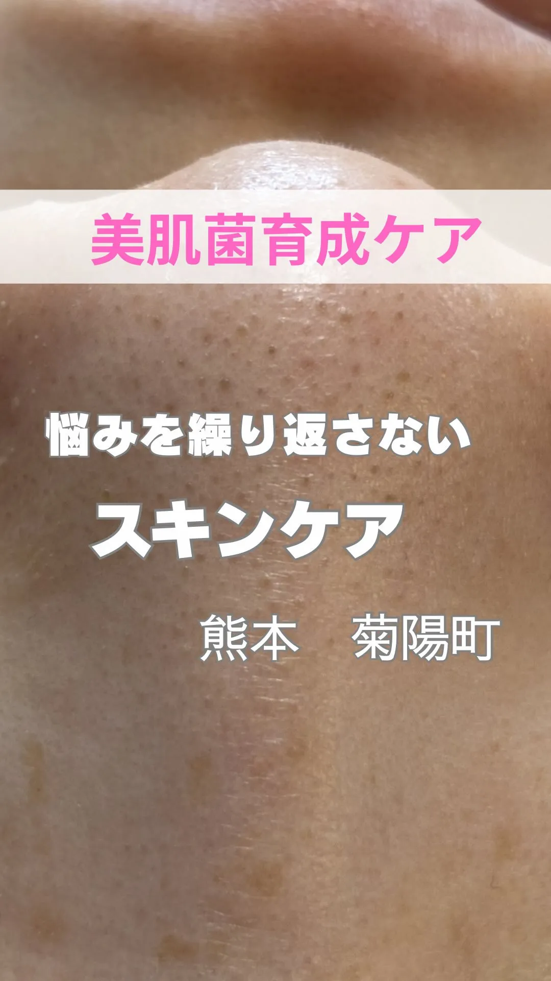 ＼悩みやを繰り返さないお肌ケア／