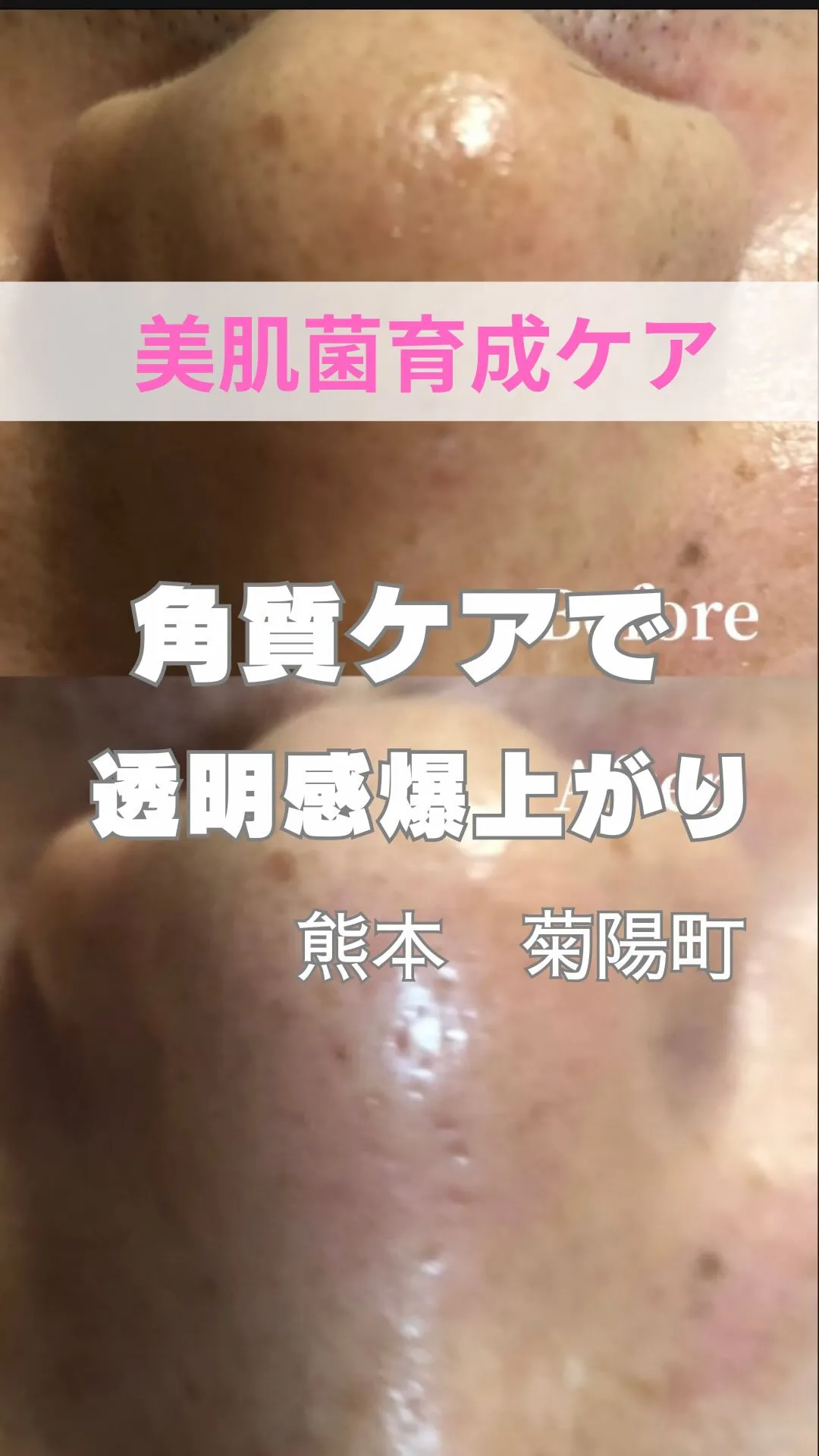 ＼角質ケアで透明感爆上がり／