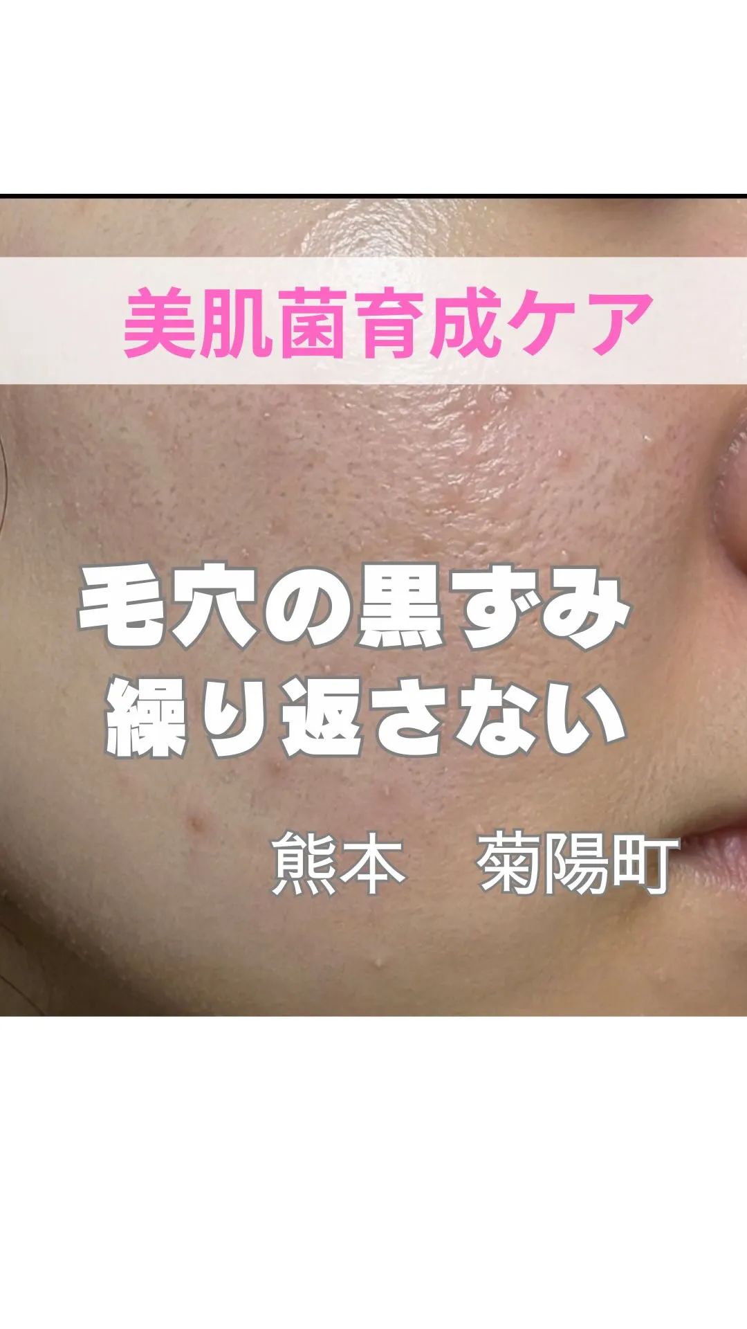 ＼黒ずみを繰り返さない美容／