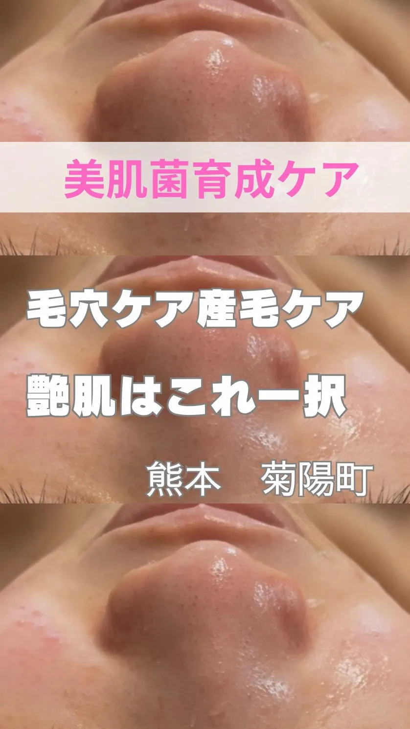 ＼角質、産毛ケアはマツヤニ一択／