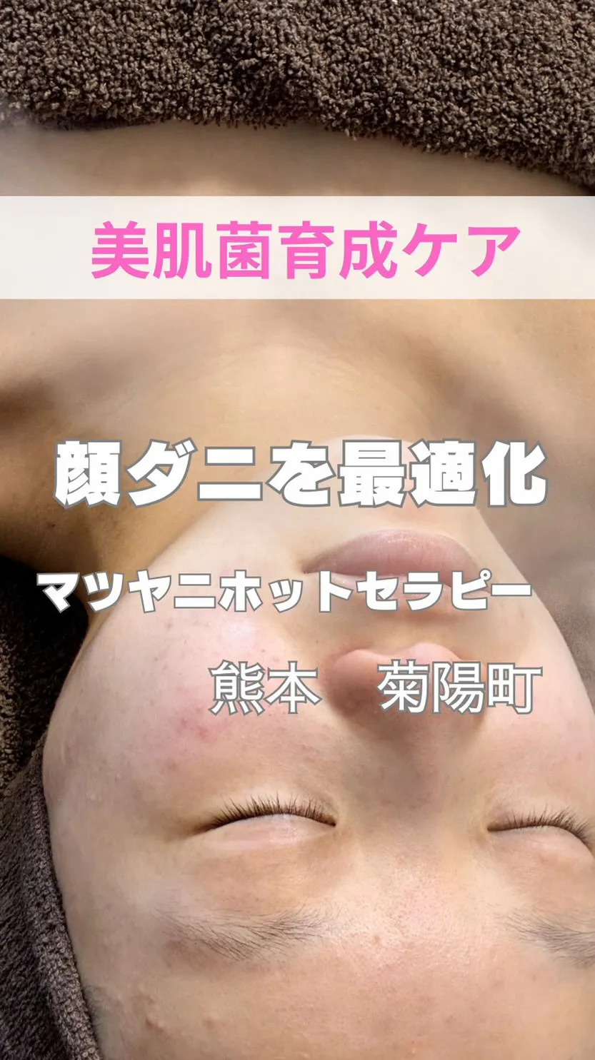 ＼顔ダニ最適化／