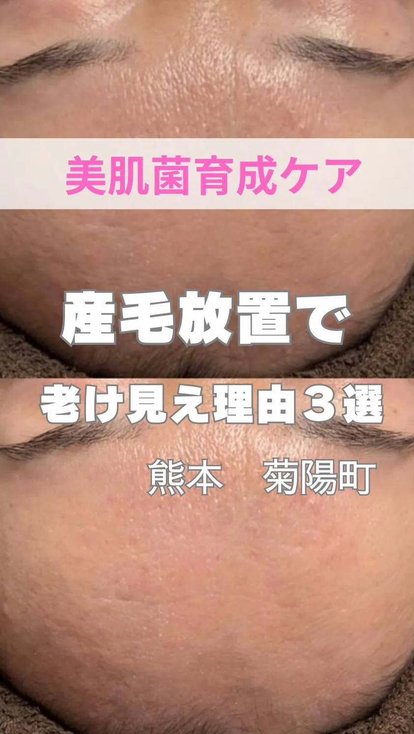 ＼産毛で老け見え理由３選／