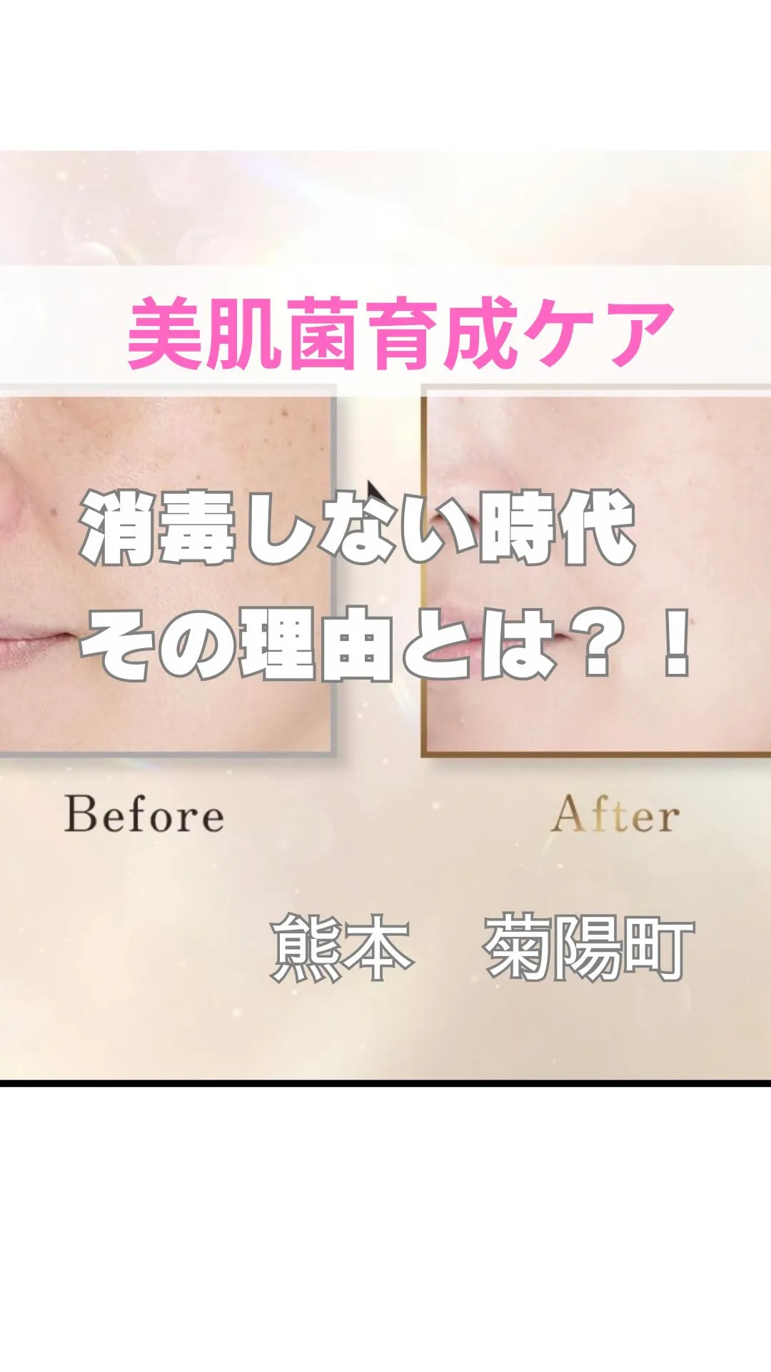 ＼傷を消毒しない理由／