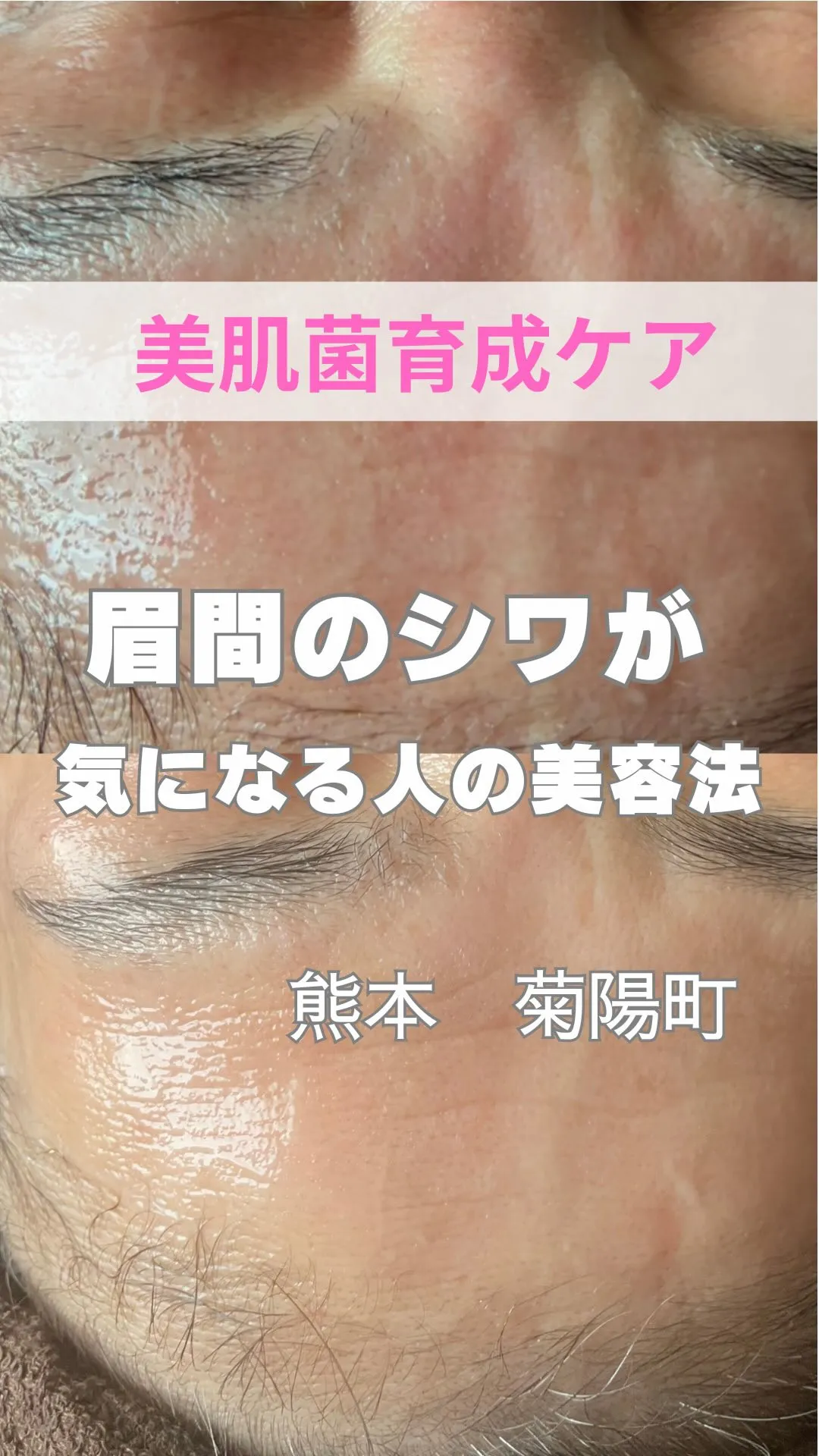 ＼眉間のシワが気になる人がやってる美容法／