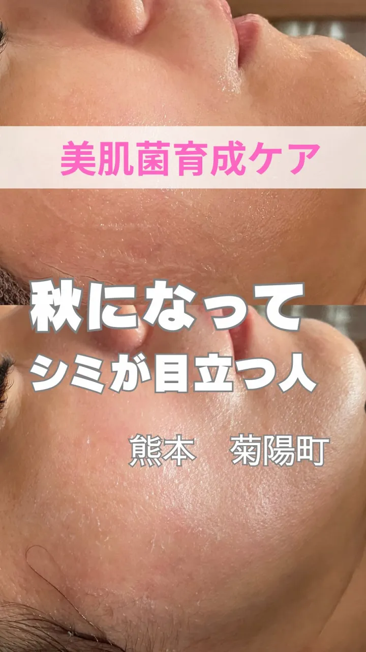 「夏よりシミが目立つ気がする…😨」